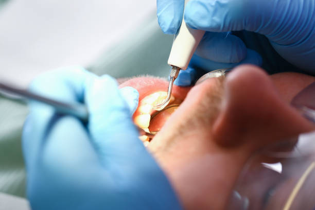 Professional Emergency Dental Service in MA