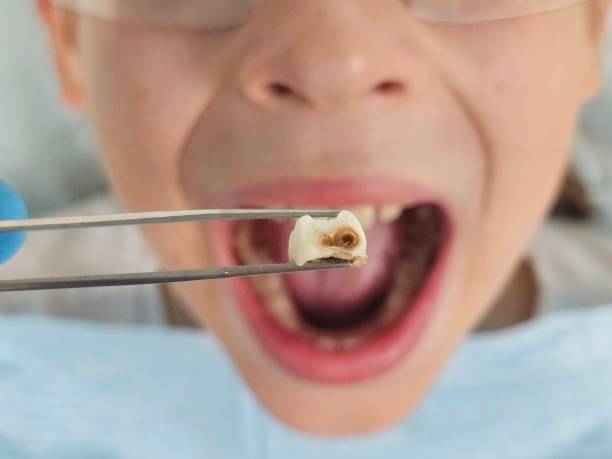 Best Emergency Pediatric Dental Care in Whitinsville, MA